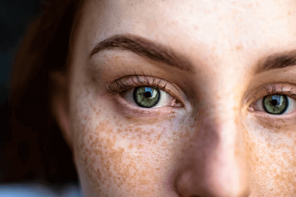 Femme avec des taches de rousseur sur le visage et les paupières