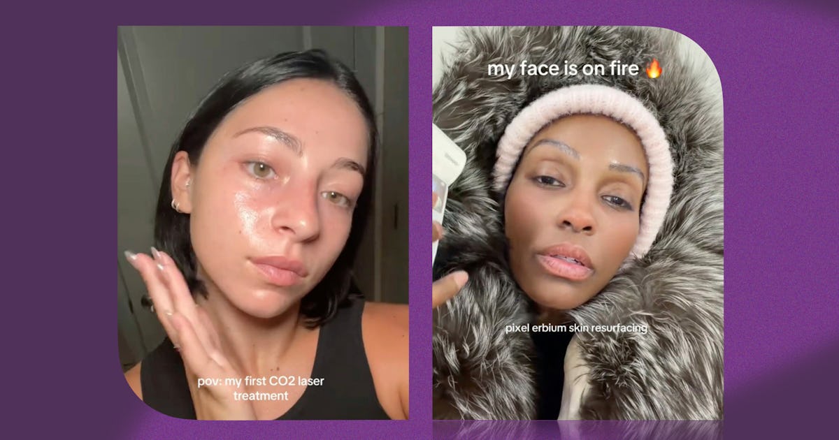 Est-il temps de réinitialiser votre peau chaque année ?