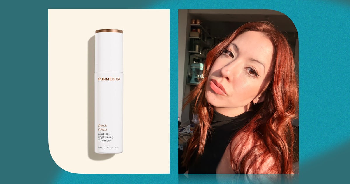 L’extrait de pousse de lotus a enfin éliminé mes marques post-acnéiques tenaces