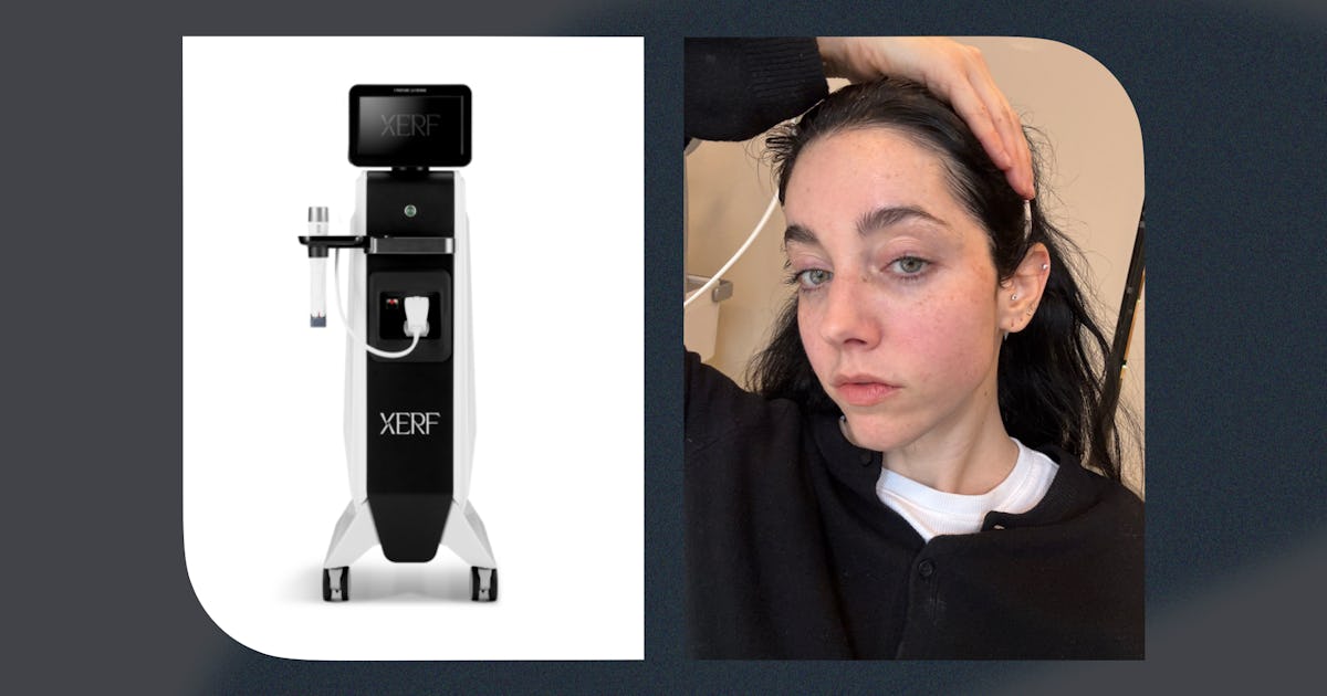 XERF est-il la chose la plus proche d’un lifting instantané ?