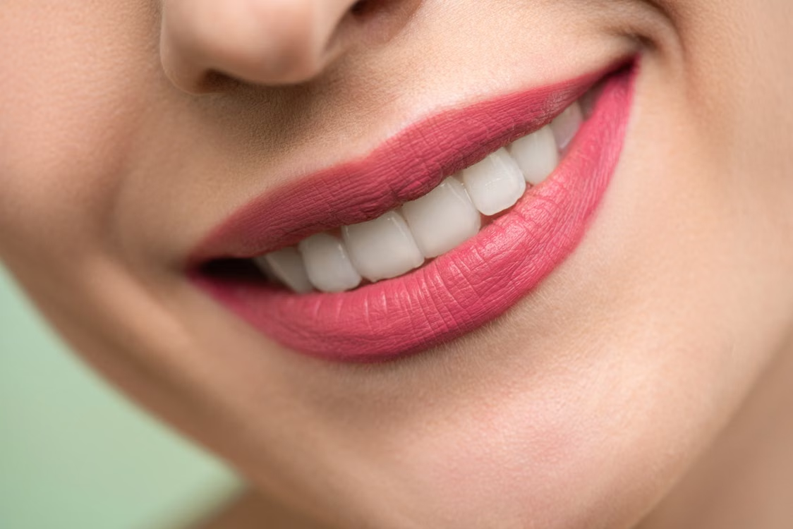 Le guide des amoureux de la beauté sur les mythes concernant les facettes et le relooking du sourire